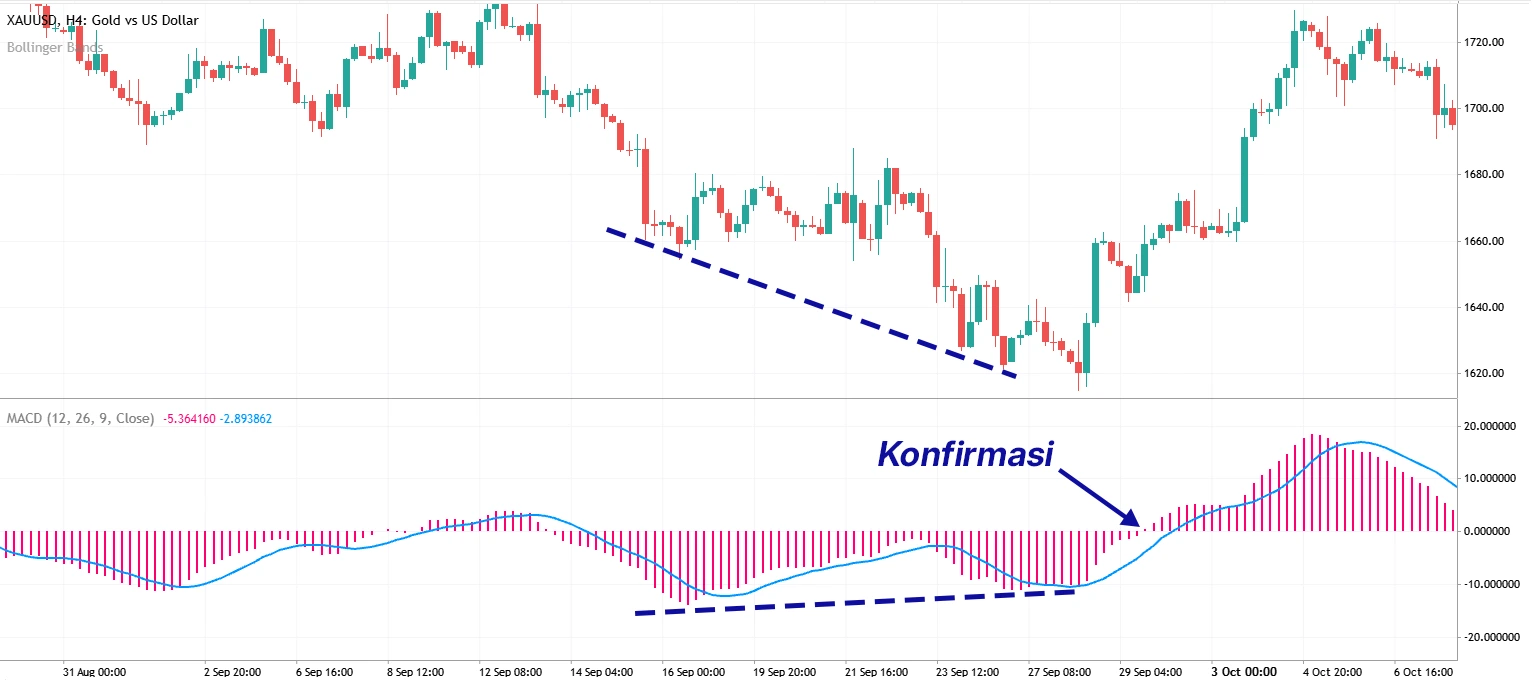 MACD 3